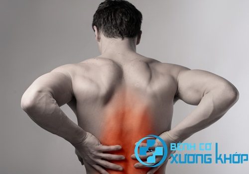 Những cơ đau xuất hiện thường xuyên cảnh báo bệnh thoát vị đĩa đệm