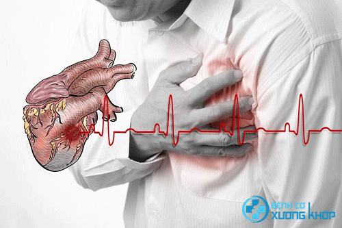 Nhồi máu cơ tim khiến não không được nuôi dưỡng