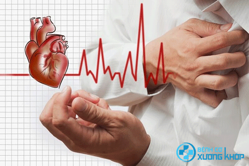 Dấu hiệu chính xác nhất nhận biết cơn nhồi máu cơ tim ở người trẻ