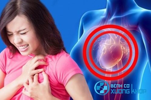 Bác sĩ chuyên khoa chỉ ra một số dấu hiệu cảnh báo cơn nhồi máu cơ tim