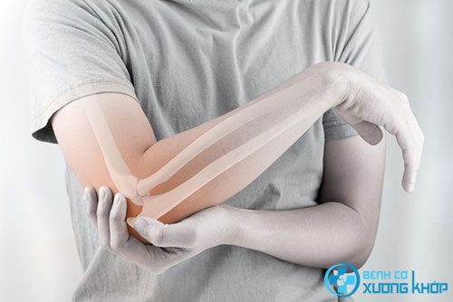 Bộ phận khuỷu tay dễ mắc các bệnh cơ xương khớp.
