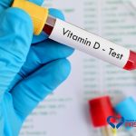 Chỉ định thực hiện xét nghiệm vitamin D